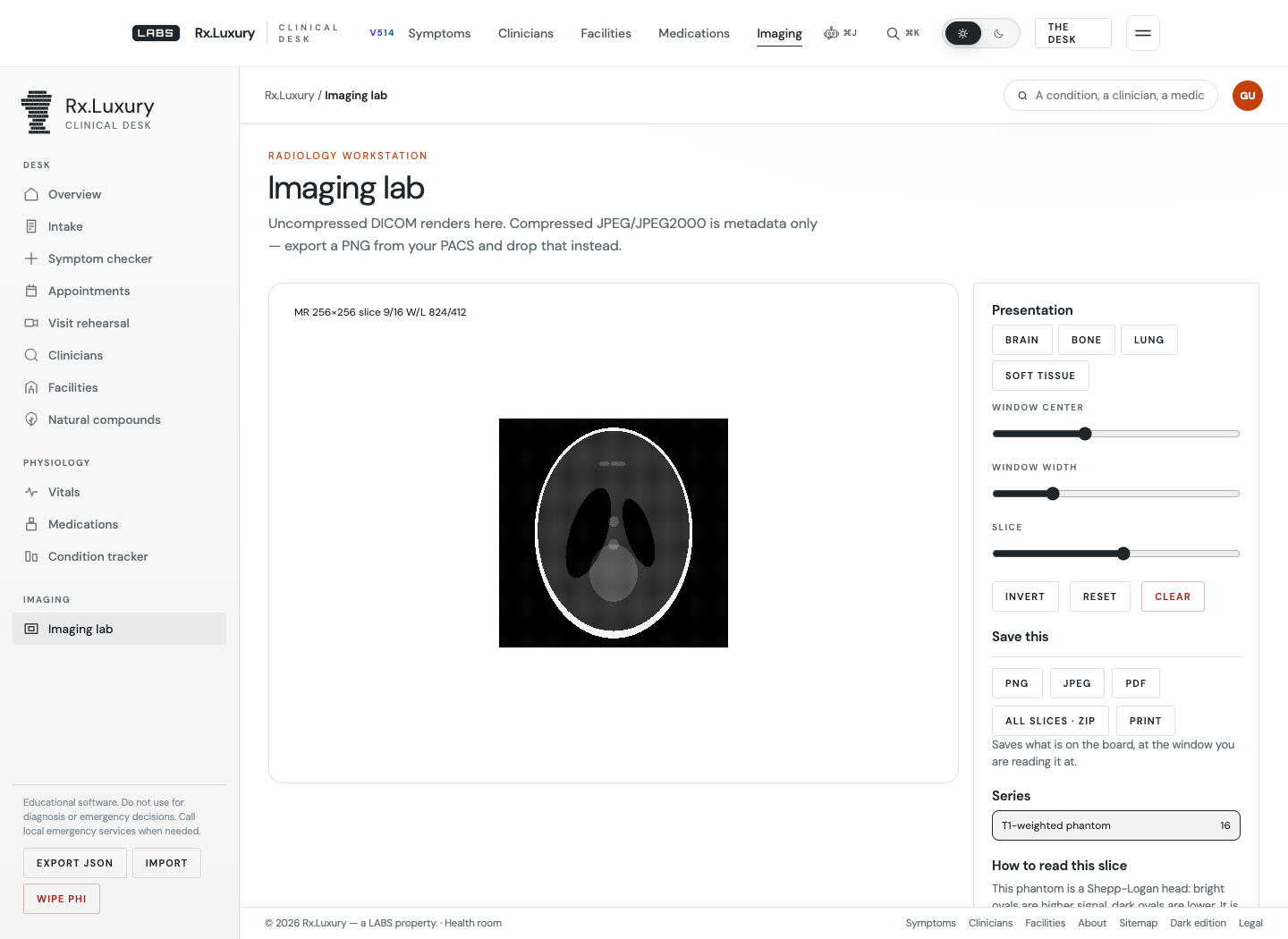 The same imaging lab with the phantom loaded: a greyscale Shepp-Logan head phantom on a black canvas, a heads-up display reading